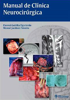 521332_manual-de-clinica-neurocirurgica-691974_M1
